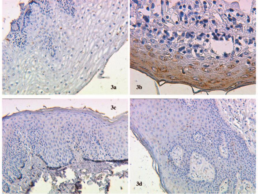 Wiest et al: Carbohydrate Tumour Markers in Normal Epithelial of the Penis and Vagina Figure 3.