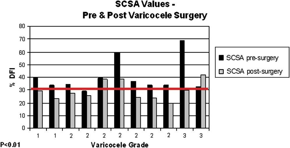 FIGURE 2 SCSA values before and after surgery. Ninety percent of patients showed a decrease in percent DNA fragmentation index (DFI) 3 to 6 months after varicocelectomy (P<.01). Werthman.