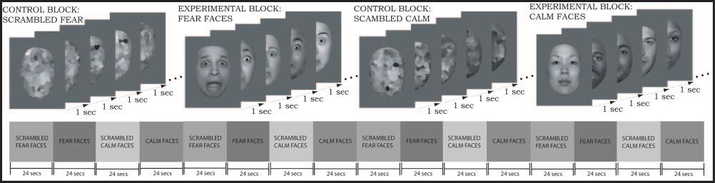Amygdala dysfunction in FMR1 premutation Brain (2007), 130, 404 416 407 Fig. 1 Images and presentation timing used in the fmri protocol.