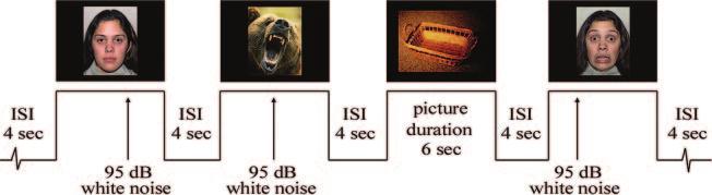 408 Brain (2007), 130, 404 416 D. Hessl et al. Fig. 2 Examples of images and presentation timing used in the potentiated startle experiment. according to the normative ratings.