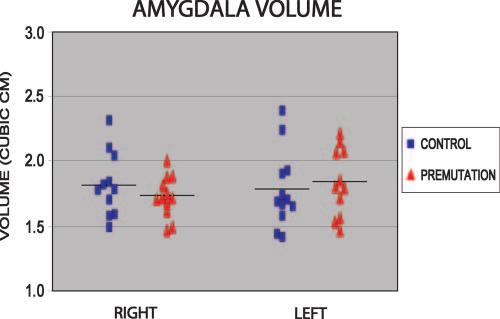 Amygdala dysfunction in FMR1 premutation Brain (2007), 130, 404 416 409 either group. In the premutation group, FMR1 mrna was significantly correlated with left amygdala volume (r = 0.59, P < 0.