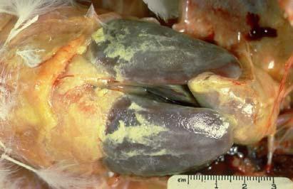 Postmortem lesions 2. Yellow fibrin on heart, liver (figure 11.31) and viscera organs, caseous air sacs, mucous in trachea, and green livers can be seen. Figure 11. 31.