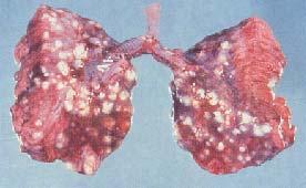 Figure 13.0. Nodules in the lungs Figure 13.1. Nodules in the trachea Diagnosis 1.