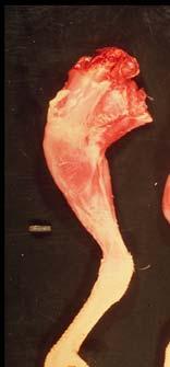 Very close and proximal to the first bone on the medial side of the shaft of the fused mass of the male is a hooked process. This is the base of the spur.