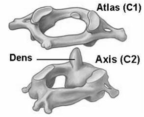 C2 Lower C spine C3-C7 UPPER C SPINE C1 Atlas C2 Axis