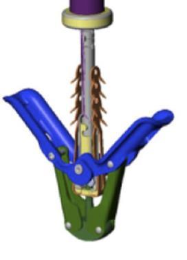 More clinical data exists for the MitraClip than other percutaneous leaflet repair or annuloplasty devices, and two important studies have recently been published from the EVEREST II clinical trial.