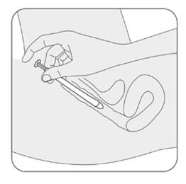 Issued: April 2017 PPINRUS00043 STEP 6 Gently slide the vaginal insert end of the applicator into your vagina as far as