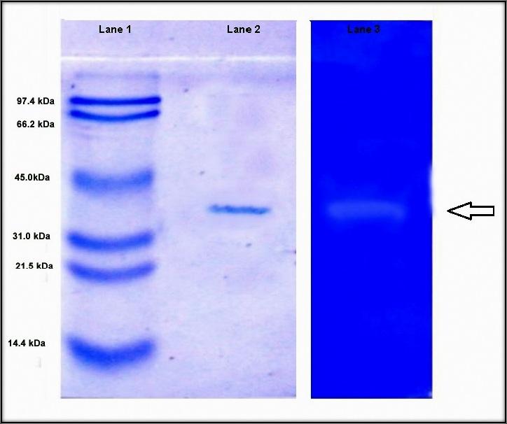 4.3.3.2 Zymogram analysis The purified protease PSA BP-07 was subjected to zymogram analysis.
