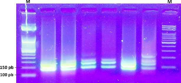 Slika 6. Provjera uspješnosti PCR-a za umnažanje biljega D1S243 (M biljeg poznatih veličina). Prema literaturi, vrpce smo očekivali između 142 i 170 pb.