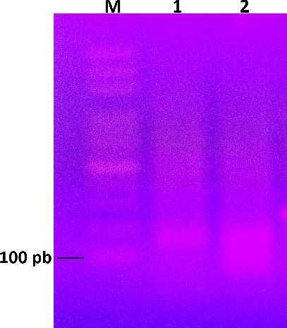 Slika 10. Prikaz rezultata provjere uspješnosti PCR-a za umnažanje biljega D1S243 (M biljeg poznatih veličina; 1 uzorak rađen pri uvjetima iz Benn i sur.