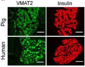 Dopamine regulates Insulin-secretion Highly-specific dopamine transporter in human beta-cells (VMAT2) Same amount of dopamie and insuline in the secretory vesicles Dopamine is secreted together with