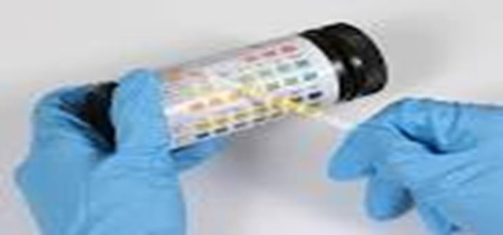 Urinalysis Assessment of urine can provide vital information as to whether the damage is within the kidneys or as a result of pre renal cause.