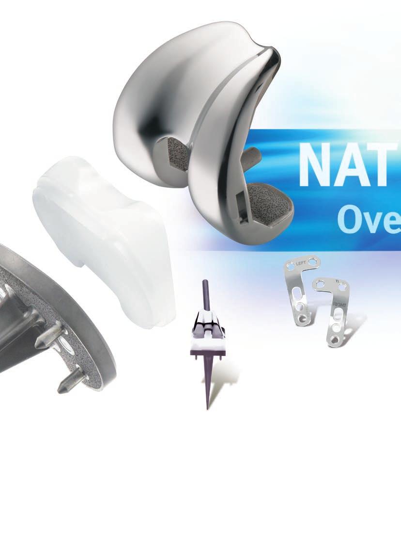 Natural-Knee II Revision and Constrained System Interchangeable and bone conserving, the components in our Natural-Knee II Revision System restore kinematic function, enhance stability, and