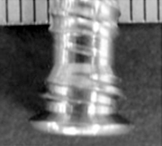 8 mm. This implant is minimally invasive under the skin; however, this thin plate may cause some issues in the locking system because the number of threads at the screw head is two in FlexitSystem,