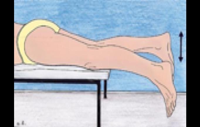 b. SUBTLE FIXED FLEXION DEFORMITY OF THE KNEE Position the patient prone, on a firm table, with the knees supported on the table and the legs protruding beyond the table's edge.