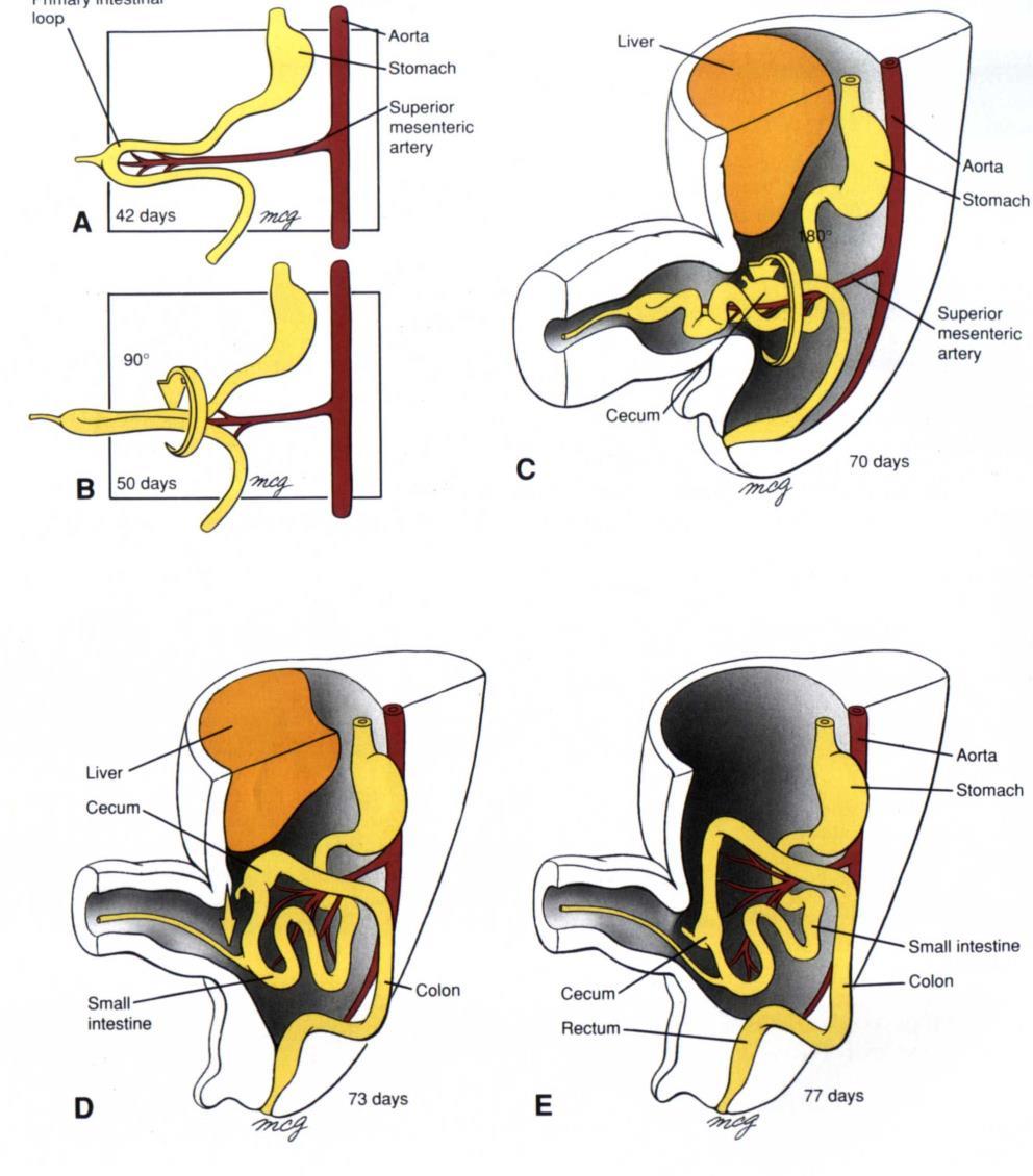 Axis of rotation is around superior mesenteric artery Rotation is 90 o anticlockwise Growth in length of the cranial limb; herniation into the umbilical