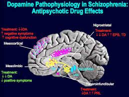 Schizophrenia-