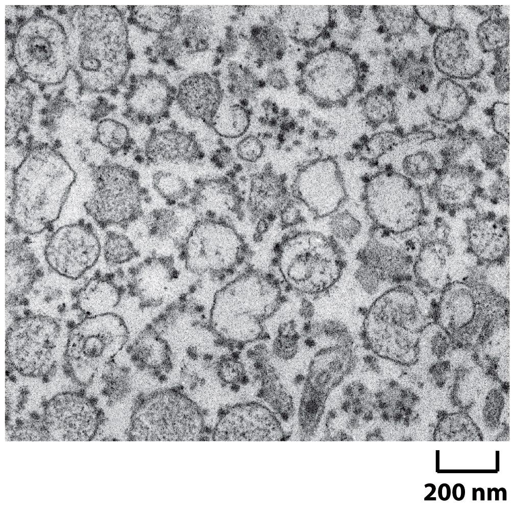 The Isolation of Purified Rough and Smooth Microsomes from the ER (A) A thin section electron