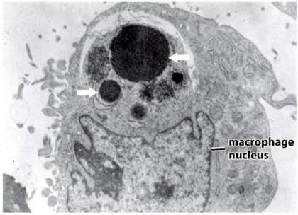 Unlike necrosis, where the cell dies by swelling and bursting its content in the area, which causes an inflammatory response.