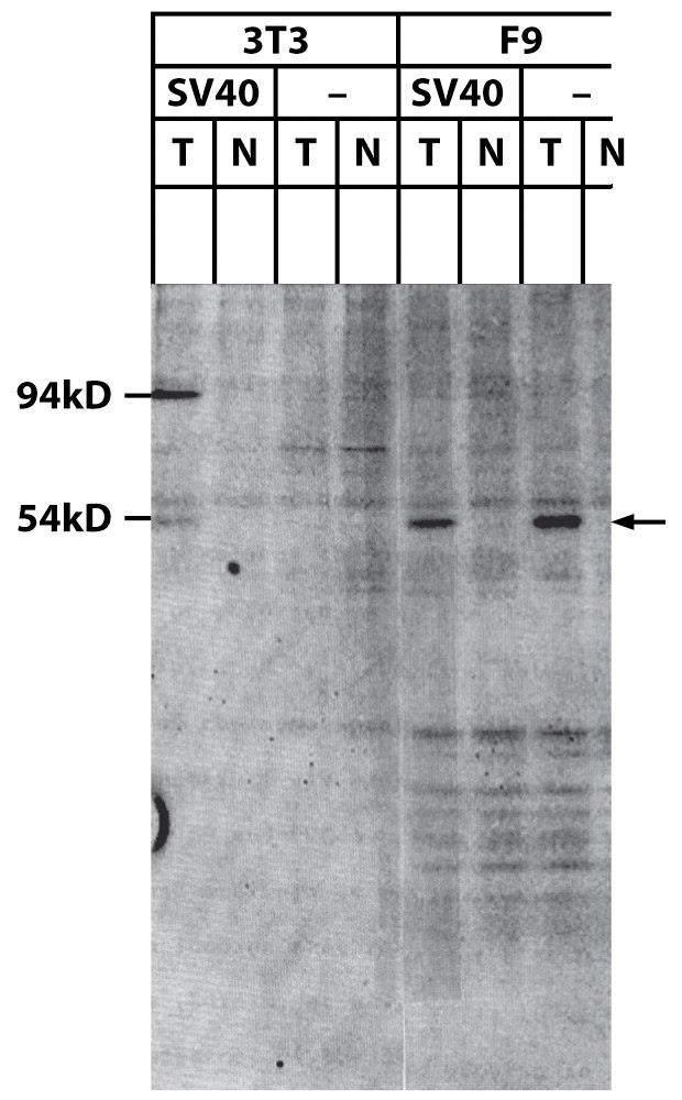 SV40 transformed 3T3 hamster cells and F9 mouse embryonal carcinoma express p53 protein 35 S-methionine labeled lysates of 3T3 cells anti-tumor serum immunoprecipitation (IP) 94 kda (SV40 large T)