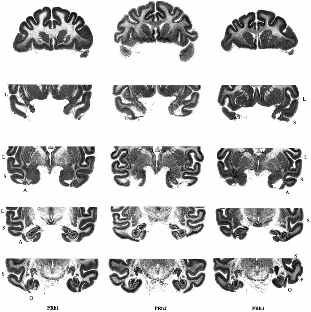 2270 J. Neurosci., March 15, 1998, 18(6):2268 2275 Buckley and Gaffan Perirhinal Ablation Impairs Visual Identification Figure 1.