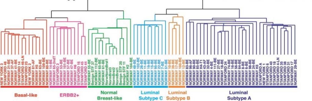 Molecular heterogeneity reveals specific intrinsic subtypes of breast cancer Unsupervised analysis of global gene