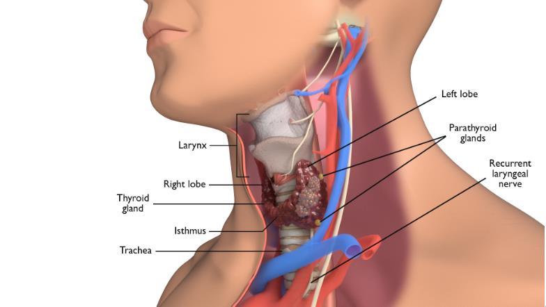 THYROIDECTOMY This infrmatin aims t help yu understand the peratin, what is invlved and sme cmmn cmplicatins that may ccur.