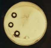 1: Antifungal & Antibacterial bioactivity of marine derived fungi against dermatophytes, food spoilage