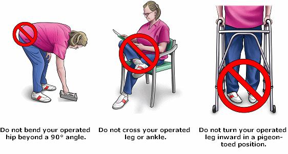 Preoperative patient teaching Postoperative regimen is explained Isometric exercises taught Gluteal, quadriceps, foot pumps, etc Bed-to-chair transfer shown Within hip flexion limits of no greater