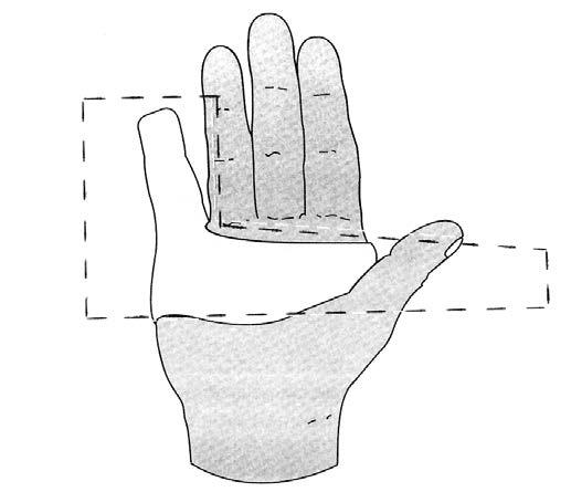 PIP Extension Orthosis (digits 2 or 5) Fractures of middle phalanx Contractures Ruptured extensor tendon Procedure: Cut a wide L shape where the short side