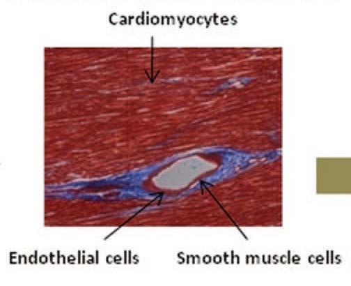 Cardiac Regeneration : Stem Cell Therapy Potentially reparing myocardium Delivery of MSCs