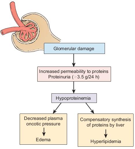 Nephrotic syndrome = constellation of clinical findngs that result from increased glomerular