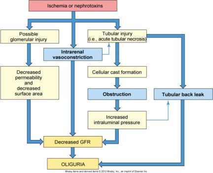 Oliguria in Acute Kidney Injury (AKI) Figure from: Huether & McCance, Understanding Pathology, 5 th ed.