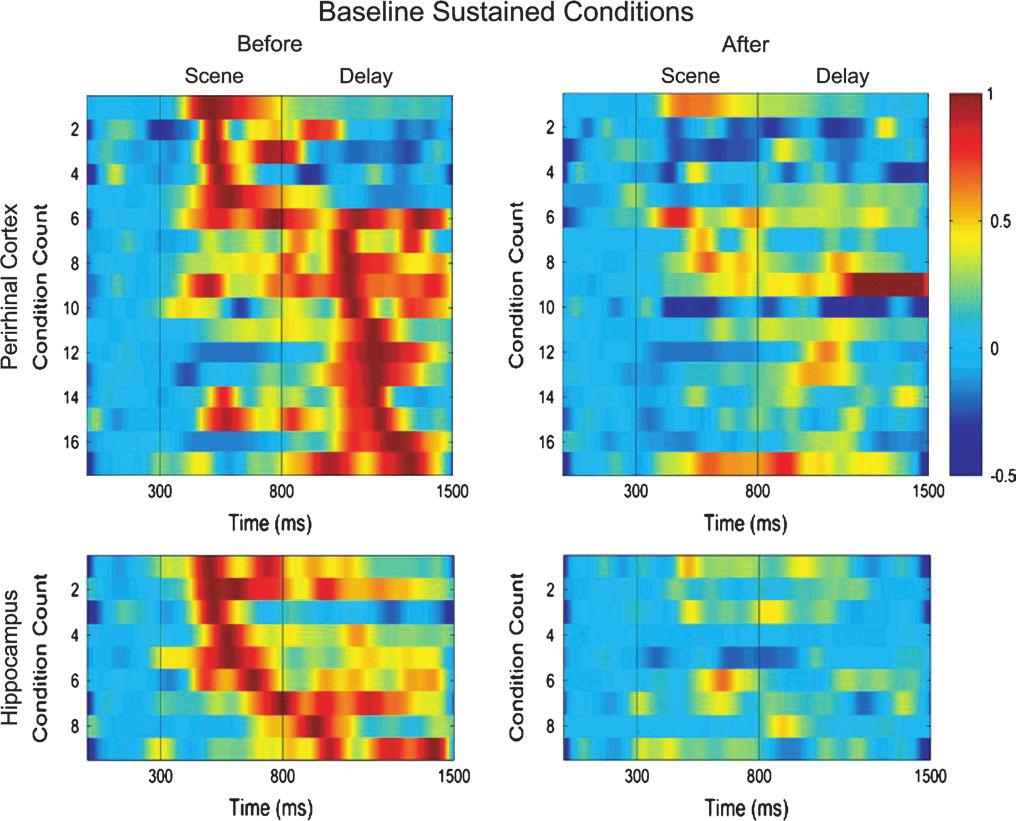 Figure 7. Illustration of the patterns of neural activity seen within trials for all baseline sustained conditions in the perirhinal cortex (top 2 panels) and hippocampus (bottom 2 panels).