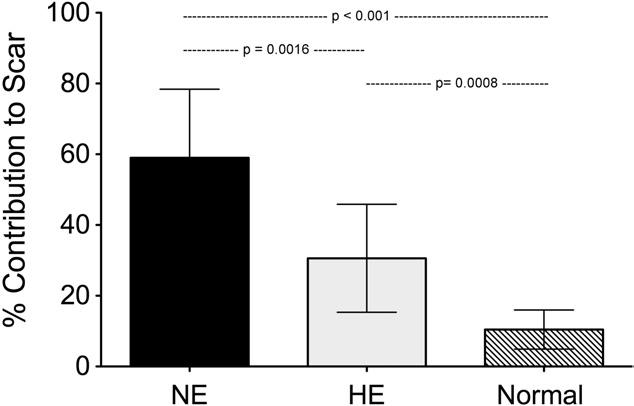 gadolinium enhancement (nonenhanced [NE] hyperenhanced [HE] 72.0%) does not correlate well with late scar (33.9%). HE 37.7 12%, NE 34.3 13%, scar 33.9 8%.