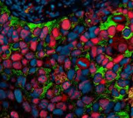An approach to utilizing multiplexed IHC in targeted drug development Explore