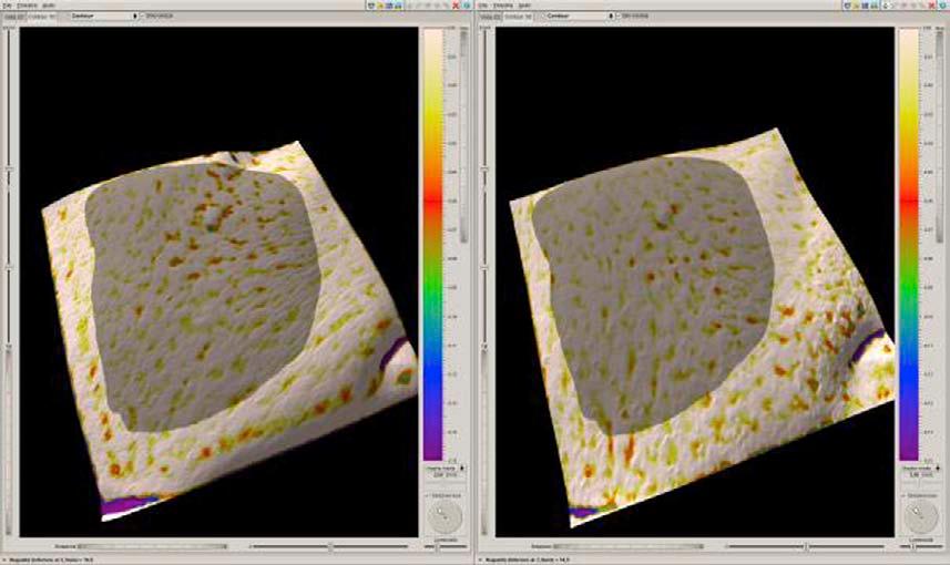 3D In Vivo Optical Skin Imaging 747 crumbling the pigment granules at different depth.