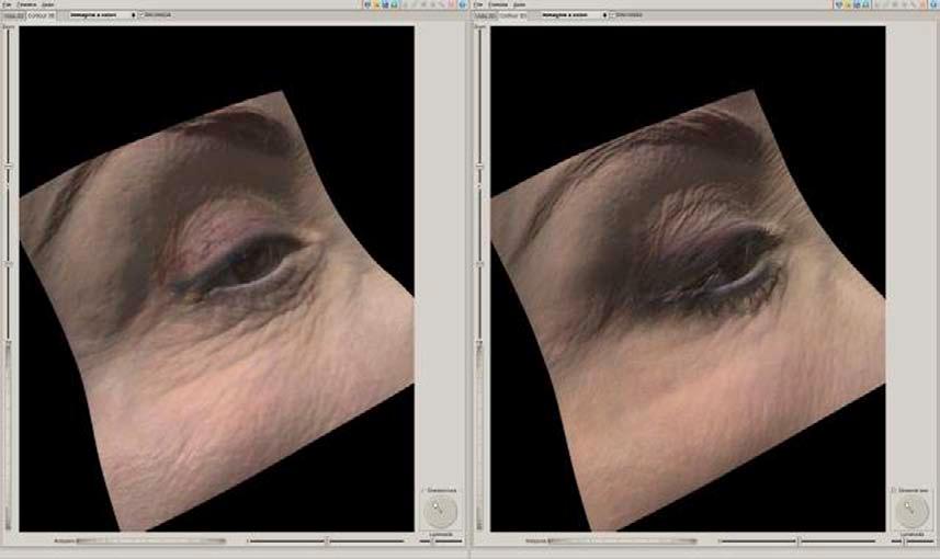 3D In Vivo Optical Skin Imaging 753 Fig. 21.