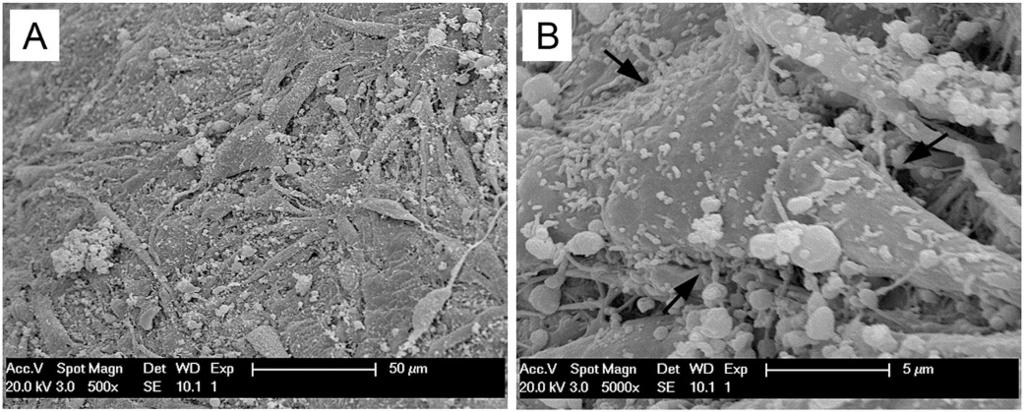 Xie et al. Arthritis Research & Therapy Page 6 of 15 Figure 2 Scanning electron microscopy of MSC-laden PRP scaffolds. MSCs adhere to the PRP fibrin fibers (adhesion sites indicated by arrows in B).