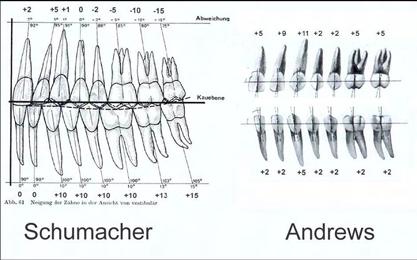 than on the maxillary, results from teeth natural displacement Fig.