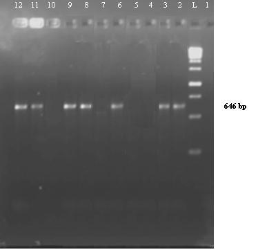 2464 Tebyanian et al/ Int. J. Adv. Biol. Biom. Res, 2014; 2 (8), 2461-2465 Figure (2): The katg gene of Isoniazid resistance of M.