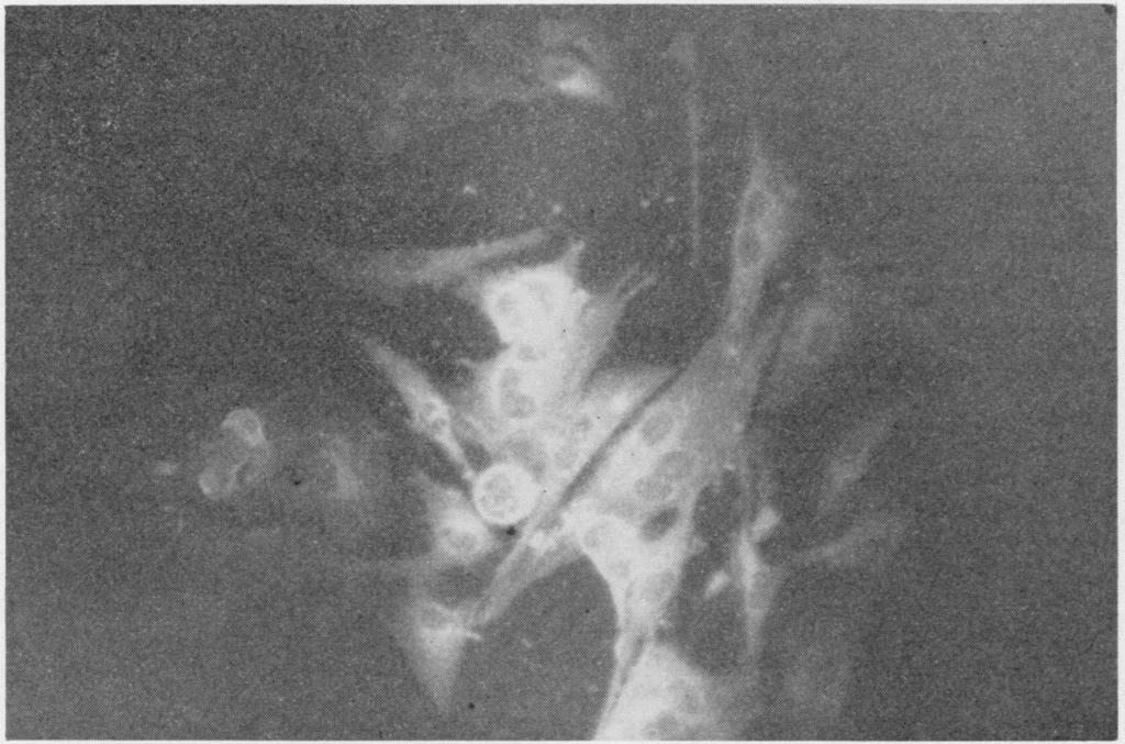 VOL. 4, 1971 ANTIBODIES AGAINST VISNA VIRUS 717 FIG. 1. Visna-infected sheep choroid plexus cell monolayer treated ith immune rabbit serum and stained ith fluorescein-labeled goat anti-rabbit globulin globulin.
