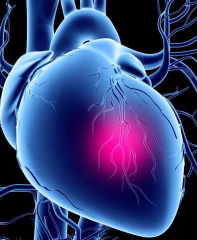 Syndrome Significant risk factor for Cardiovascular
