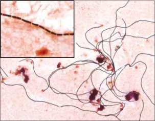 Inhalation Anthrax: Pathway Deposition in alveolar space Macrophage ingestion Transport to