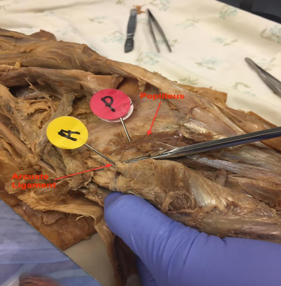 Appendix A Dissection Images Figure 14.