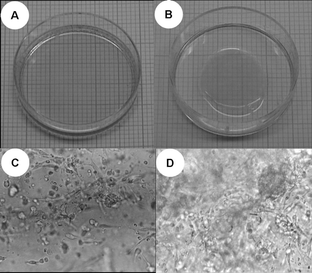 FIGURE 2 Photographs of a collagen gel matrix and testicular cells within the collagen gel mixture before and after culture in vitro.