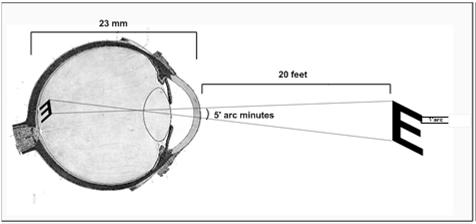 Visual Acuity Visual Acuity 20 20 = distance to chart = letter size (5 arc at 20 feet) 10 20 = 20 40 IMPORTANT Best corrected vision (with glasses or pinhole) Test at distance (20 ft) if