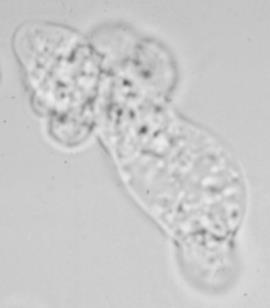Acanthamoeba Protozoa found in soil and freshwater Resistant to