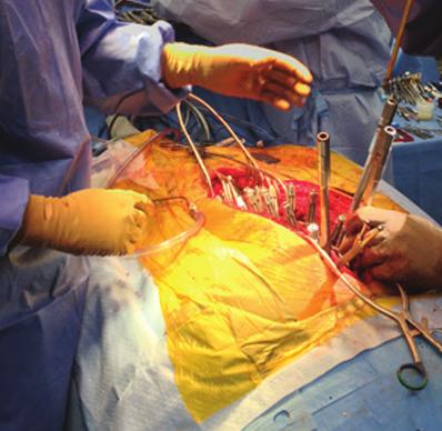 intraoperative results immediately in the procedural room Fast intra-op scanning