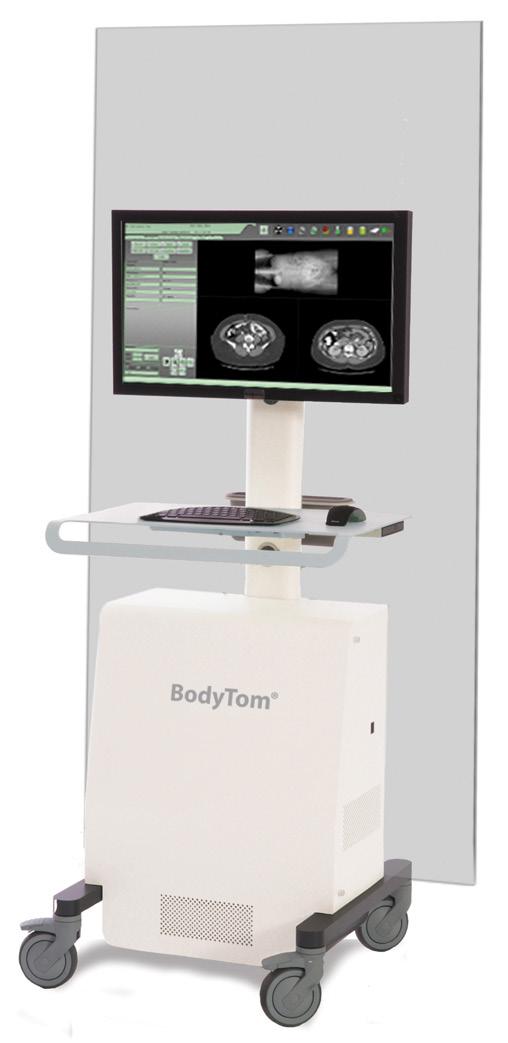 Uniquely designed to accommodate patients of all sizes, BodyTom provides point-of-care CT imaging wherever high quality CT images